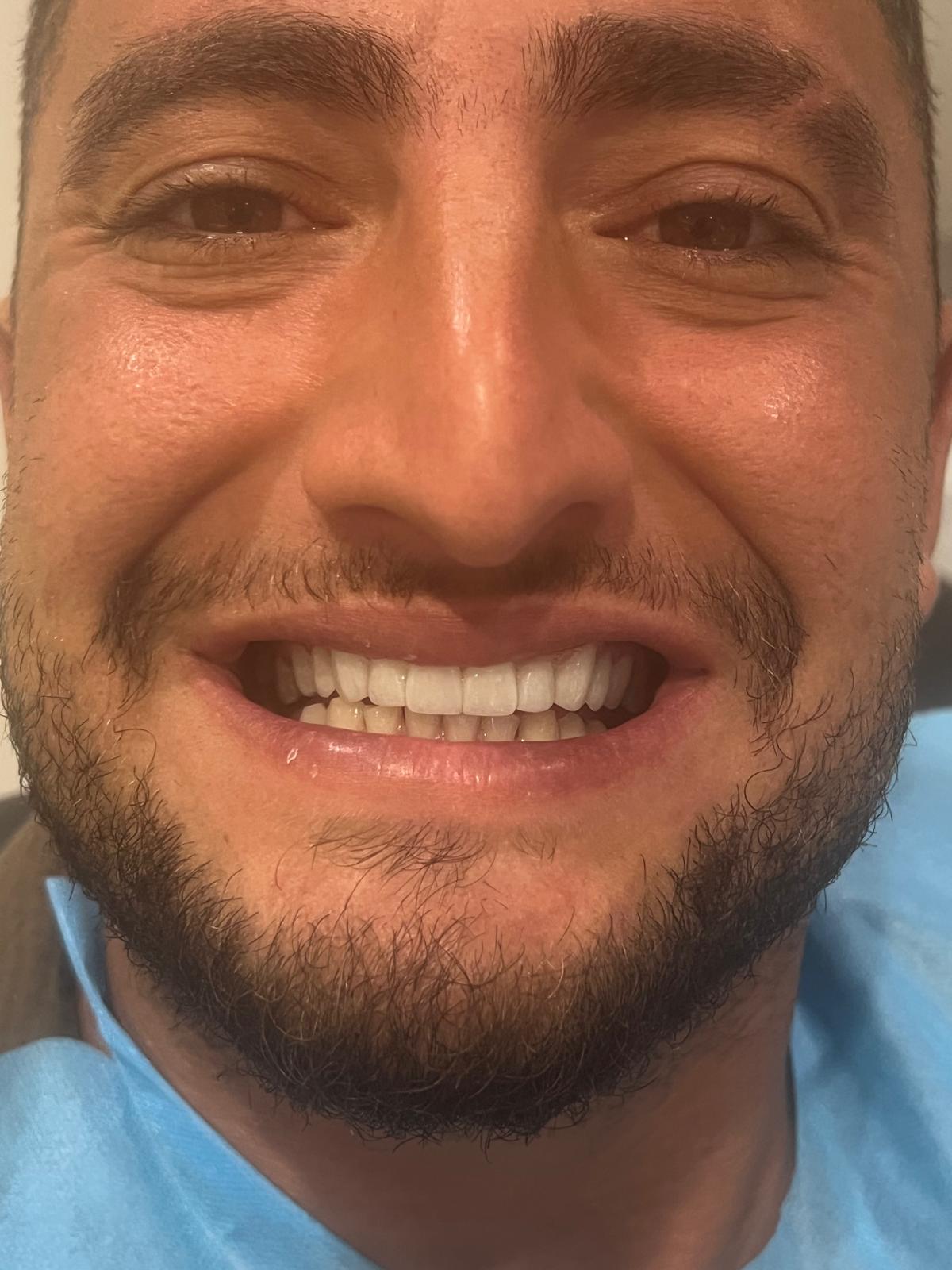 ECE Dental Patient Transformation